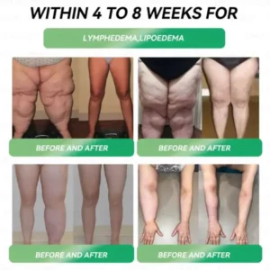 𝐑𝒆𝒔𝐮𝐥𝐭𝐬 𝒊𝒏 𝟕 𝐝𝒂𝐲𝐬✅𝐁𝐨𝒔𝒕𝗼𝗿𝗲® 𝐺𝑳𝐏 -1 𝐌𝐢𝐜𝒓𝒐𝒄𝒂𝒑𝘀𝘂𝗹𝗲 𝗕𝘂𝗿𝐬𝐭 𝑷𝒂𝙩𝙘𝙝🌱𝐎𝐛𝐞𝐬𝐢𝐭𝐲,𝑪𝒂𝒓𝒅𝒊𝒐𝒗𝒂𝒔𝒄𝒖𝒍𝒂𝒓 𝑫𝒊𝒔𝒆𝒂𝒔, 𝗗𝗶𝗮𝗯𝗲𝘁𝗲𝘀, 𝗦𝗹𝗲𝗲𝗽 𝗔𝗽𝗻𝗲𝗮, 𝐉𝐨𝐢𝐧𝐭 𝐏𝐫𝐨𝐛𝐥𝐞𝐦𝐬, 𝐚𝐧𝐝 𝐌𝐨𝐫𝐞