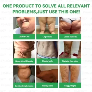 𝐑𝒆𝒔𝐮𝐥𝐭𝐬 𝒊𝒏 𝟕 𝐝𝒂𝐲𝐬✅𝐁𝐨𝒔𝒕𝗼𝗿𝗲® 𝐺𝑳𝐏 -1 𝐌𝐢𝐜𝒓𝒐𝒄𝒂𝒑𝘀𝘂𝗹𝗲 𝗕𝘂𝗿𝐬𝐭 𝑷𝒂𝙩𝙘𝙝🌱𝐎𝐛𝐞𝐬𝐢𝐭𝐲,𝑪𝒂𝒓𝒅𝒊𝒐𝒗𝒂𝒔𝒄𝒖𝒍𝒂𝒓 𝑫𝒊𝒔𝒆𝒂𝒔, 𝗗𝗶𝗮𝗯𝗲𝘁𝗲𝘀, 𝗦𝗹𝗲𝗲𝗽 𝗔𝗽𝗻𝗲𝗮, 𝐉𝐨𝐢𝐧𝐭 𝐏𝐫𝐨𝐛𝐥𝐞𝐦𝐬, 𝐚𝐧𝐝 𝐌𝐨𝐫𝐞