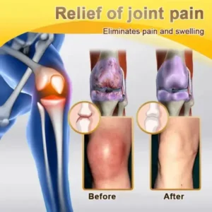 PolarFresh® Bee Venom & Botulinum Toxin Joint Pain Relief & Repair Cream– Fast Relief & Joint Repair