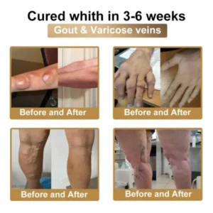 PolarFresh® Bee Venom & Botulinum Toxin Joint Pain Relief & Repair Cream– Fast Relief & Joint Repair