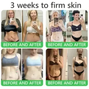 𝐎𝐫𝐢𝐚𝐜𝐡® 𝐀𝟏𝟎+ 𝟔-𝐢𝐧-𝟏 𝐃𝐞𝐫𝐦𝐚𝐑𝐞𝐩𝐚𝐢𝐫 𝐒𝐞𝐫𝐮𝐦 𝐅𝐃𝐀 𝐂𝐞𝐫𝐭𝐢𝐟𝐢𝐞𝐝 – 𝐅𝐢𝐫𝐦𝐬 𝐥𝐨𝐨𝐬𝐞 𝐬𝐤𝐢𝐧, 𝐟𝐚𝐝𝐞𝐬 𝐛𝐫𝐮𝐢𝐬𝐢𝐧𝐠 𝐚𝐧𝐝 𝐬𝐞𝐧𝐢𝐥𝐞 𝐩𝐮𝐫𝐩𝐮𝐫𝐚, 𝐚𝐧𝐝 𝐢𝐦𝐩𝐫𝐨𝐯𝐞𝐬 𝐤𝐞𝐫𝐚𝐭𝐢𝐧 𝐛𝐮𝐢𝐥𝐝𝐮𝐩, 𝐬𝐞𝐛𝐨𝐫𝐫𝐡𝐞𝐢𝐜 𝐝𝐞𝐫𝐦𝐚𝐭𝐢𝐭𝐢𝐬, 𝐚𝐧𝐝 𝐟𝐨𝐥𝐥𝐢𝐜𝐮𝐥𝐚𝐫 𝐤𝐞𝐫𝐚𝐭𝐨𝐬𝐢𝐬.