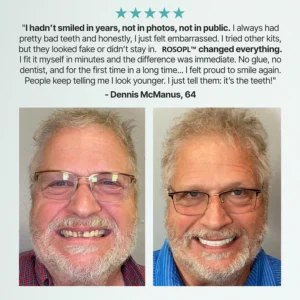 🔥 Don't Miss Out! 70% OFF ROSOPL™ Custom Dentures for a Perfect, Confident Smile!