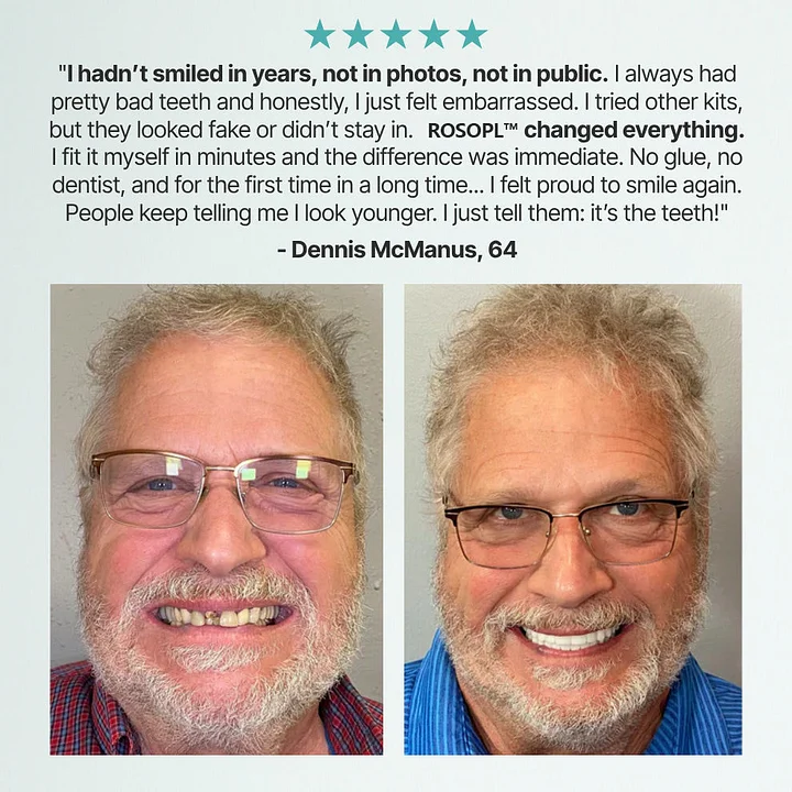 🔥 Don't Miss Out! 70% OFF ROSOPL™ Custom Dentures for a Perfect, Confident Smile!