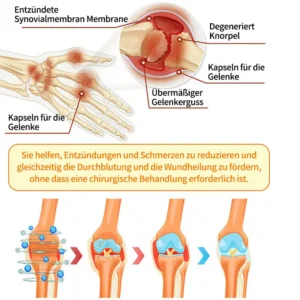 🐝 Offizieller Online-Shop丨Purelora® Bee Venom & Lithospermum Comfort Cream Wenn Gehen, Stehen oder Schlafen unangenehm wird — tägliche Schmerzlinderung & Knochenkomfort für ältere Erwachsene