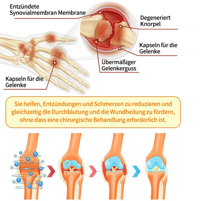 🐝 Offizieller Online-Shop丨Purelora® Bee Venom & Lithospermum Comfort Cream Wenn Gehen, Stehen oder Schlafen unangenehm wird — tägliche Schmerzlinderung & Knochenkomfort für ältere Erwachsene