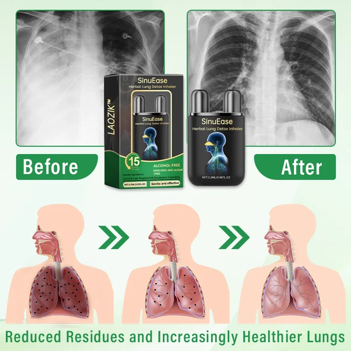 LAOZIK™ SinuEase Herbal Lung Detox Inhaler