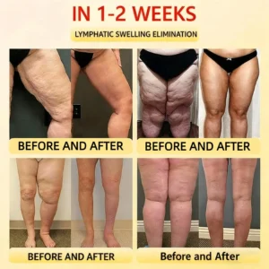 Alisanda™ Self-regulating tourmaline shaping shorts with titanium fiber