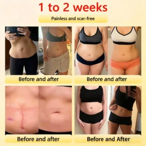 Alisanda™ Self-regulating tourmaline shaping shorts with titanium fiber