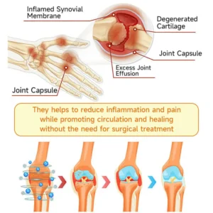 Purelora® Bee Venom Advanced Therapy - Deep Bone Healing & Instant Pain Relief Cream