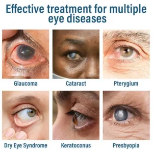 ROSOPL™ Nano Eye Drops Spray