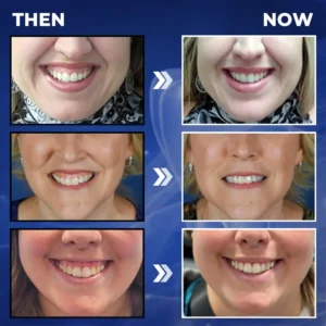 Rolimey® BeeTakt Bee Venom Dental Treatment Drops Mouthwash