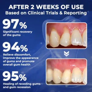 Rolimey® BeeTakt Bee Venom Dental Treatment Drops Mouthwash