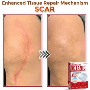 Yunpso™ MicroNeedle Botanic Skin Tag Removal Patch