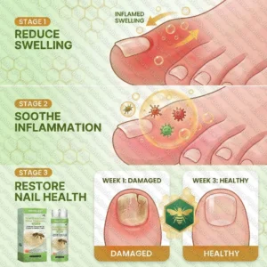 Healrize® NailRescue Bee Venom Spray