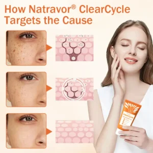 Natravor® ClearCycle Skin Renewal Gel
