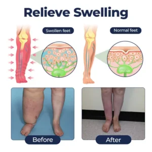 Natravor® SwellRelief Circulation Support Cream