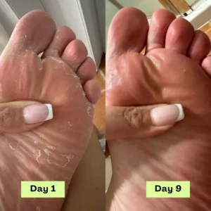 LOVILDS® AntiFungal Relief Soap Bar