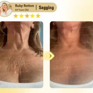 Rosopl® Anti-Aging Moisturizing Cream