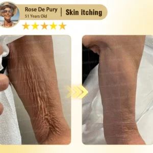 Rosopl® Anti-Aging Moisturizing Cream