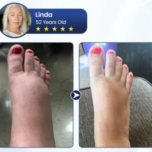 Rosopl® SwellRelief Circulation Support Cream