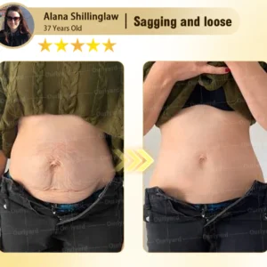 Rosopl® Anti-Aging Moisturizing Cream