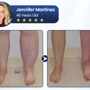 Rosopl® SwellRelief Circulation Support Cream