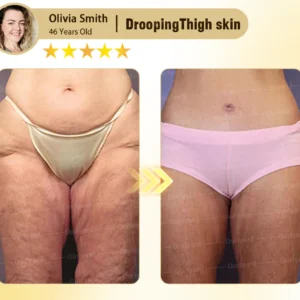 Rosopl® Anti-Aging Moisturizing Cream