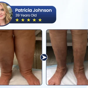 Rosopl® SwellRelief Circulation Support Cream