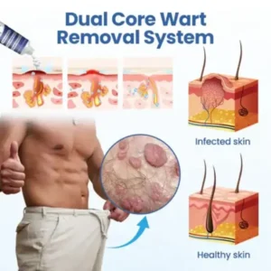 Alisanda® WartRelief Cream