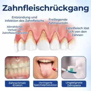 Biancat® BeeTakt Zahnfleisch-Repair Lösung