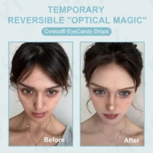 Rosopl® EyeCandy Drops