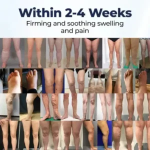 Rosopl® SwellRelief Circulation Support Cream