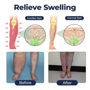 Rosopl® SwellRelief Circulation Support Cream