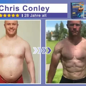 STARTYNX®NanoMedix™ Gynecomastia Breast Fat Burning & Firming Patch