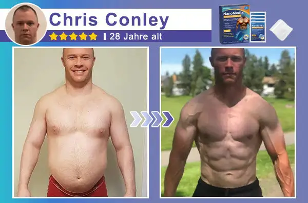 STARTYNX®NanoMedix™ Gynecomastia Breast Fat Burning & Firming Patch