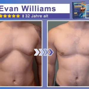 STARTYNX®NanoMedix™ Gynecomastia Breast Fat Burning & Firming Patch