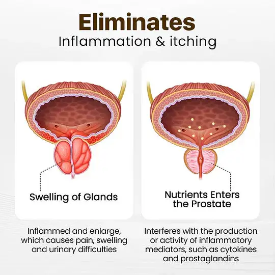 Startynx™ Bee Venom Men+ – Prostate Comfort & Male Vitality