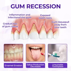 Biancat® SensiGum Fluoride Toothpaste