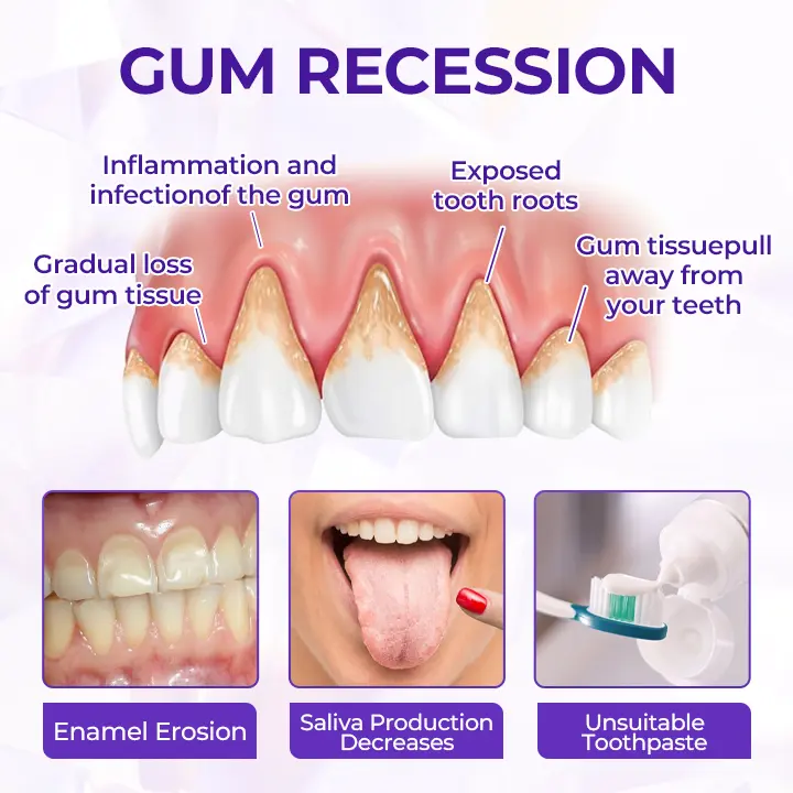 Biancat® SensiGum Fluoride Toothpaste