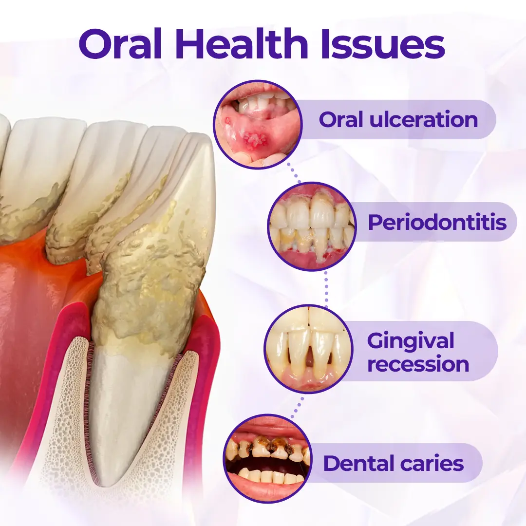 Biancat® SensiGum Fluoride Toothpaste
