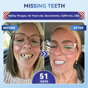Glimmerly® Tooth & Gum Repair