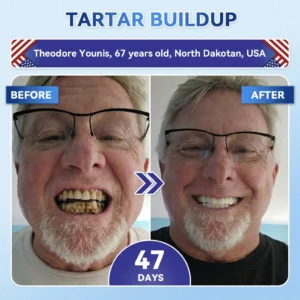 Glimmerly® Tooth & Gum Repair