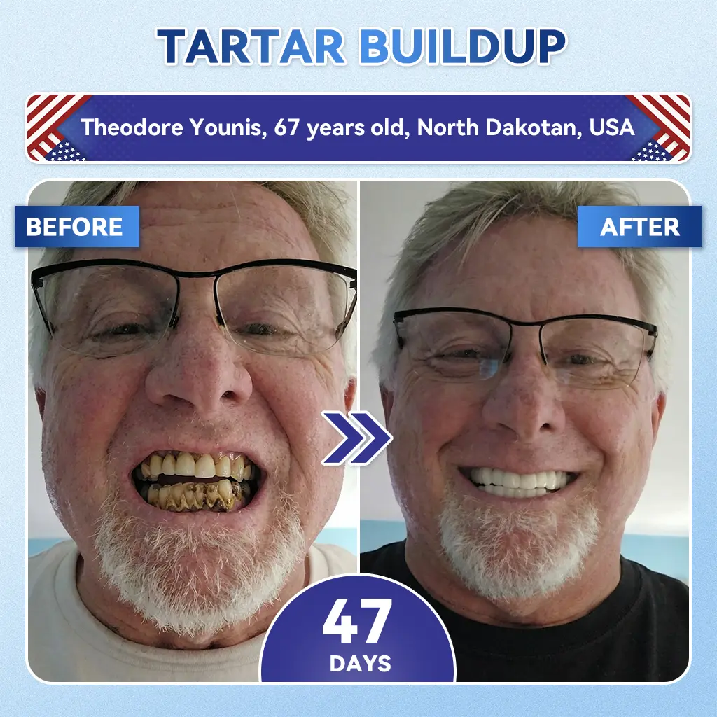 Glimmerly® Tooth & Gum Repair