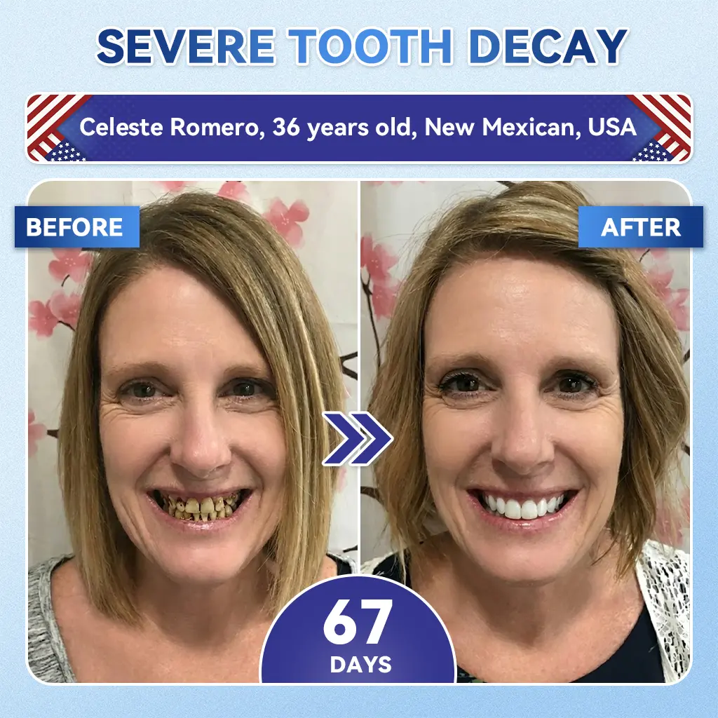 Glimmerly® Tooth & Gum Repair