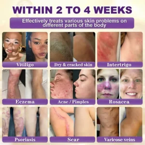 Made and Shipped from USA🍁Clinclii® Biotin 10-in-1 Skin Restoration Cream - Last Day Promotion: 75% OFF