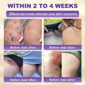 Made and Shipped from USA🍁Clinclii® Biotin 10-in-1 Skin Restoration Cream - Last Day Promotion: 75% OFF