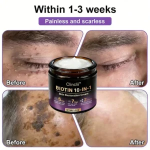 Made and Shipped from USA🍁Clinclii® Biotin 10-in-1 Skin Restoration Cream - Last Day Promotion: 75% OFF