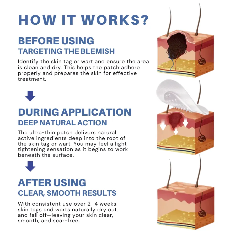 ODALIT™ Moles & Warts Removing Skin Tag Patch