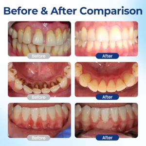 Bloeamly Bee Repair Complex Oral Repair Solution