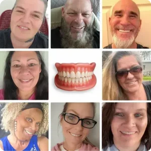 🔥🔥🔥Ends Today: 70% OFF!🦷Pryxo™ Custom-Fit Full Functional Dentures Make you more confident